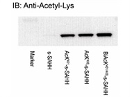 Specific Antibody for Acetylated Lysine