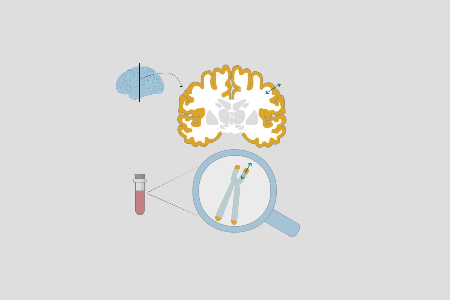 Telomeres and Brain Structure