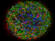Phenotypic Drug Discovery Makes a Comeback