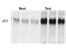 Easy Detection of p53 Expression in Western Blots
