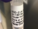 Good SOD-2 Western Blot Antibody from Santa Cruz