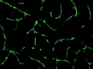 Best Antibody to Stain ZO-1