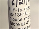 Time Course Effect of Hif-1alpha by Chemoattractant