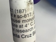 Time Course Effect of P21 by Chemoattractant