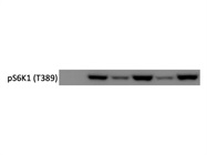 Great Antibody to Assess mTORC1 Activity