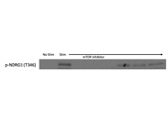 Great Antibody to Detect Downstream mTORC2 Activity of SGK1