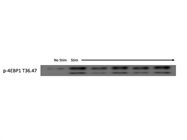 Reliable Antibody to Assess mTORC1 Activity Via Immunoblotting