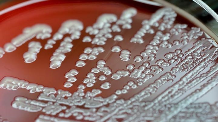 E. coli