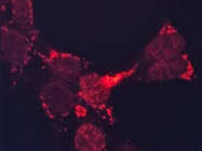 Good Antibody for Lysosome Staining in Human Cells