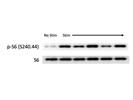 Great Antibody for Assessing Total Ribosomal S6 Protein for Immunoblotting