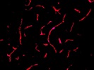 Good Rockland Antibody to Stain Endogenous Red Florescence Protein Signal