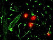 Recommended Anti-Hemoglobin Antibody