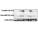 Good MMP-9 Antibody to Detect Pro and Activated Form of MMP-9 Protein