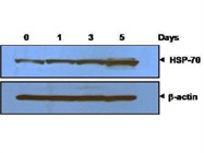 Good Antibody for Western Blotting to Detect HSP-70 Protein