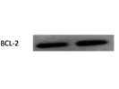 Awesome Antibody to Detect BCL-2 Expression Via Immunoblotting