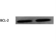 Awesome Antibody to Detect BCL-2 Expression Via Immunoblotting