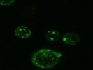 Very Nice Antibody for mTOR