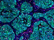 Improving Immunophenotyping Standardization