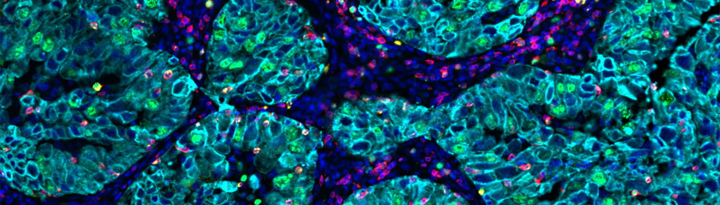  Improving Immunophenotyping Standardization