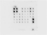 Apoptosis and Survival Protein Signaling Array
