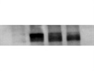 Easy-to-Use Antibody for the Detection of HIF1 Alpha