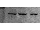 PKM1 Antibody from CST
