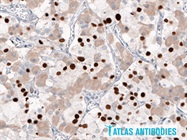 T-PIT, a Tool for Classification of Pituitary Neuroendocrine Tumors