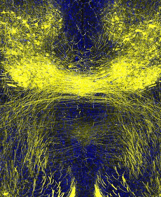 axon connectivity