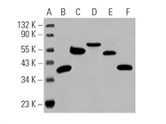 Cruz Marker™ Molecular Weight Standards