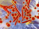 The Cost of Cell Culture Contamination