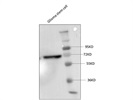 Western Blot for P65 (NF-kB) Expression in Glioma Stem Cell Whole Cell Lysate