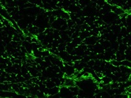 Great GFAP Antibody from Thermo Fisher