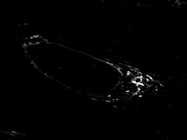 Good Antibody to Detect Elastin with Immunofluorescence