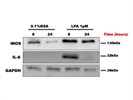 Detection of IL-6 in Microglia