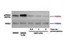 Changes in the Expression of pPKD2 in Microglia Cells