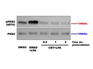 Expression of PKD2 in Microglia Cells
