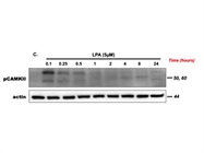 Detection of pCaMKII in Microglia
