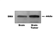 Detection of SMA Expression in Mouse Brain