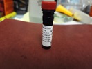 Time Course Study of CD28 Expression