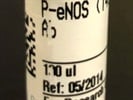 Time Point Study of P-eNOS Expression