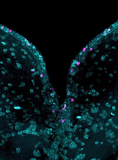 zebrafish brain cells
