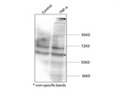 Western Blot for P65 (NF-kB) K310 Acetylation Stem Cells Whole Cell Lysate