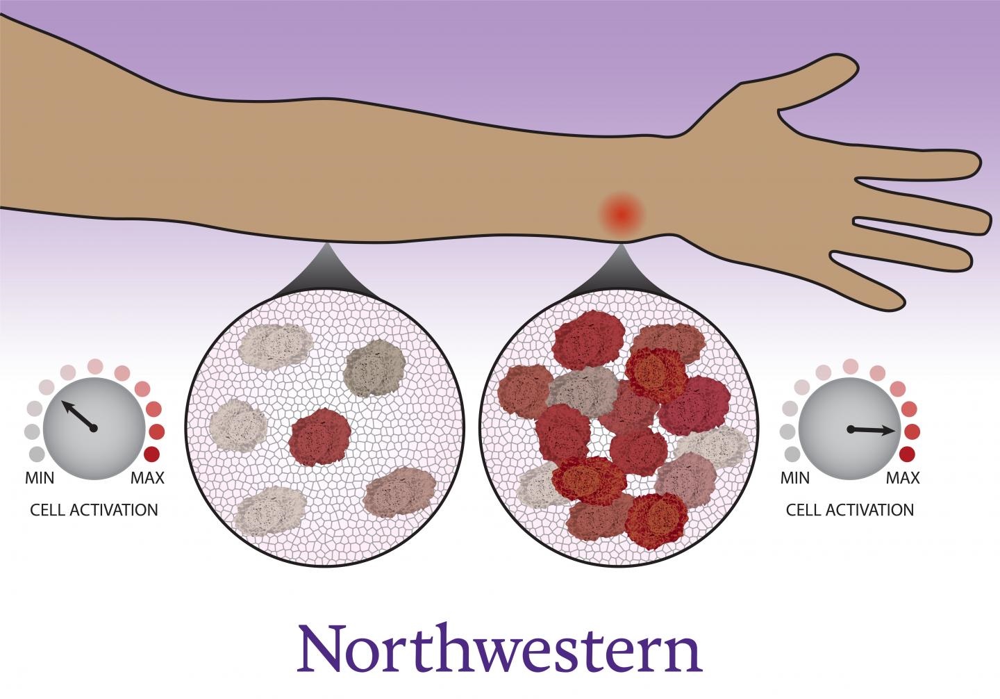 immune activation