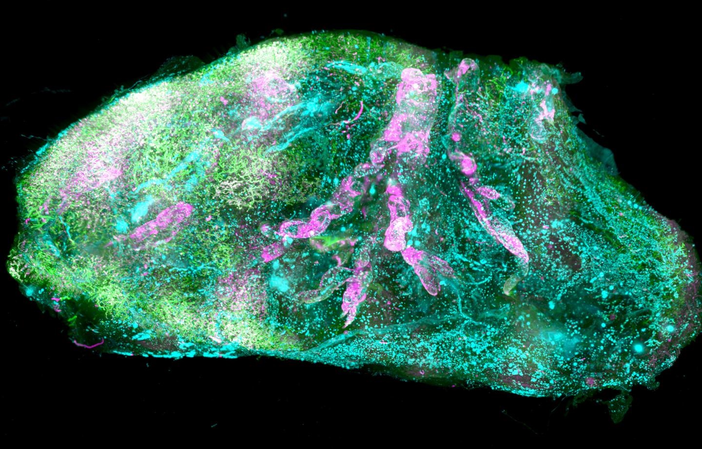 Transparent Brain