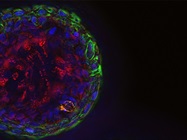 Organoids: Changing Basic Research and Medicine