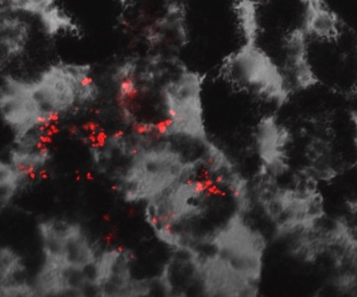 RPE cells