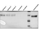 Immunoprecipitation of P65 Protein from Glioma Stem Cell Lysates