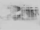 Antibody Did Not Work as Expected for the Western Blots