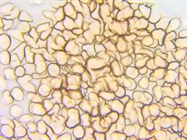 Improving PBMC Isolation with EZPREP Tubes