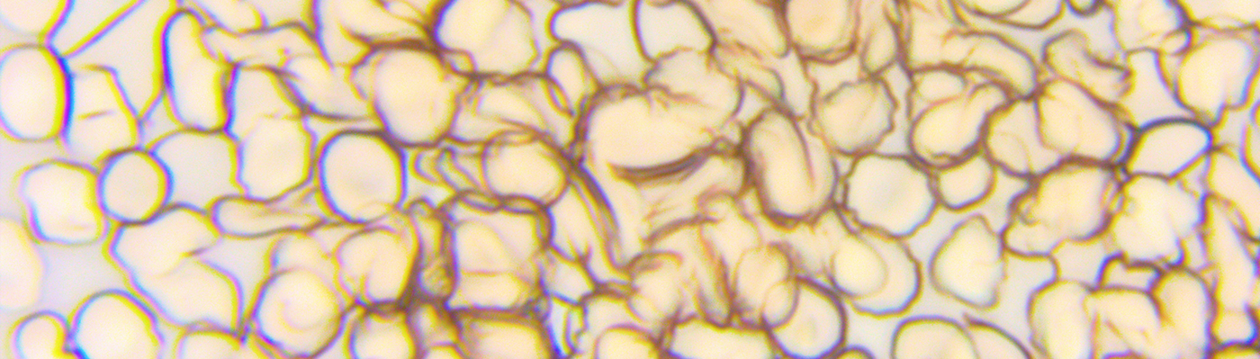  Improving PBMC Isolation with EZPREP Tubes